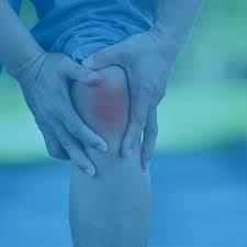 What Is Patellofemoral Pain Syndrome Your Physio Online