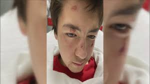 Mom wants change after son gets hit at school