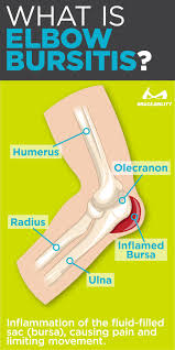 The primary difference between golfer's and tennis elbow is which tendons these conditions affect. Pin On Elbow Pain Injuries Cubital Tunnel Syndrome Tennis Golfers Elbow Tendonitis Ulnar Nerve Pain