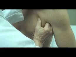 Lymph nodes, including your occipital lymph nodes, are usually about the size of a small pea or bean and in normal circumstances, can't be felt. Stanford Medicine 25 Lymph Node Exam Part 2 Youtube