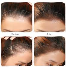 پودر پرپشت کننده مو چیست و چه مزایایی دارد؟ – فارماکالا