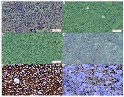 Cancers Free Full Text Lymphotropic Viruses Ebv Kshv And Htlv In Latin America Epidemiology And Associated Malignancies A Literature Based Study By The Rial Cyted Html