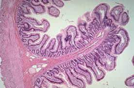Small Intestine Histology Simple Columnar Epithelium Goblet Cells Villi Intestinal Crypts And The Large Plicae Fisiologia Histologia Biologia