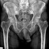 As many myeloma specialists agree, there is no one right answer to early relapse intervention for every patient. Https Encrypted Tbn0 Gstatic Com Images Q Tbn And9gctp6pcbxiifwtd0ccu7dvqkolppbpl E0r88g0jcb4 Usqp Cau