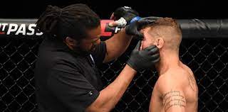 Fight night 159featherweight · main event yair rodríguez vs jeremy stephensno contest · r1 at 00 : Ufc On Espn 17 Results Yair Rodriguez Vs Jeremy Stephens Eye Poke Results In No Contest Mmaweekly Com