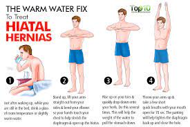 Cerebral hernia ( hernia ce´rebri ) protrusion of brain substance through a defect in the skull. Home Remedies For Hiatal Hernias Top 10 Home Remedies Holistic Health Remedies Recovery Workout Hiatus Hernia