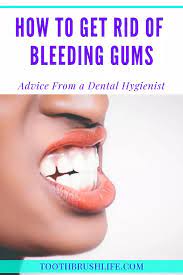 7 Causes Of Bleeding Gums Symptoms Treatments Prevention Toothbrush Life Swollen Gum Gum Treatment Swollen Gums Remedy