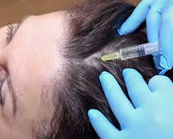 Thankfully, hair should grow back once the underlying cause of. Hair Fall Treatment Chennai Hair Loss Management Tamilnadu