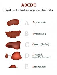 Was Ist Die Abcde Regel Quotes Images