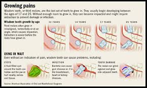 How much does wisdom teeth removal cost? Pin On Oral Surgery