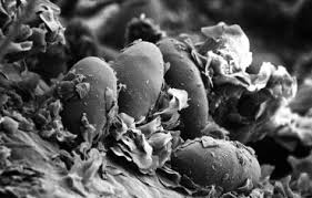 Image result for what do otodectes cynotis look like in dog fur