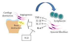 We did not find results for: Figure 5 The Roles Of Interleukin 6 In The Pathogenesis Of Rheumatoid Arthritis