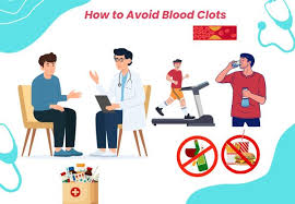 How to Avoid Blood Clots: Prevention ...