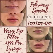 💋 *Looking for the perfect lip filler?* **Let's make it easy—because some  things in life *should* be simple (unlike assembling IKEA furniture or  figuring out where that extra sock went in the