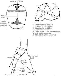 Image result for Manual Rotation in Occipitoposterior Presentation