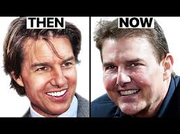 Tom Cruise: Why His Face Looks Different