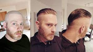 Pin On Men Hair Systems