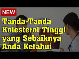 Maka jika anda memiliki faktor risiko seperti kebiasaan atau pola makan yang tidak sehat, merokok, obesitas, atau telah mengalami. Tanda Tanda Kolesterol Tinggi Yang Sebaiknya Anda Ketahui Youtube