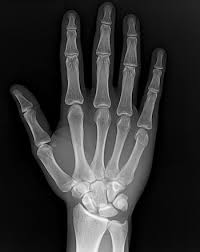 Pin By Eduardo Lopes On Radiology 2 Radiology Boxer Bone Diseases