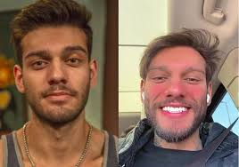 Participante de reality perde 111 quilos e surpreende com nova aparência