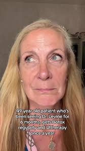 Patient TikToks with Dr. Levine: A Fun Look Behind the Scenes