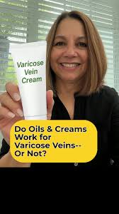 Do oils and creams actually work for varicose veins? 🤔The truth! Her...