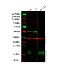Deficiency of acid sphingomyelinase 1,3,4. Recombinant Anti Niemann Pick C2 Antibody Epr19993 145 1 Ko Tested Ab218192