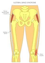 There's also an outer, or lateral, muscle — the bicep femoris. Iliotibial It Band Tendonitis Of The Knee Upswing Health