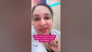 Facts you should know about lichen Planus Treatment