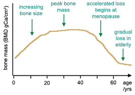 Bone Health And Epilepsy Are Your Bones Brittle