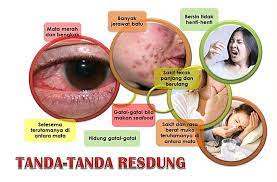 Jika ada ruam muncul di badan anda, sila dapatkan rawatan dan. Tmk Yati Tanda Tanda Resdung Facebook