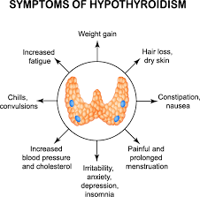 But even larger thyroid nodules are treatable, sometimes even without surgery. Hypothyroidism Underactive Thyroid Symptoms Diagnosis And Treatment Saint John S Cancer Institute Santa Monica Ca