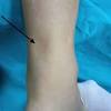 Human anatomy leg tendons leg tendons choice image human anatomy organs diagram. 1