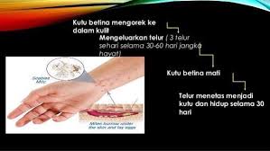 Maybe you would like to learn more about one of these? Merawat Kudis Buta Dan Gatal2 Kronik Losyen Scaboma Shopee Malaysia