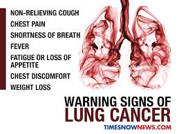 A tumor site located in the lung tissue or subpleural: Lung Cancer On The Rise Among Young Women What You Can Do To Reduce Your Risk Health Tips And News