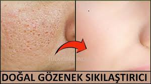 3 Kez Uygula Gozeneklerden Kurtul Dogal Gozenek Sikilastirici Guzel Dogal Akne Tedavisi Cilt Bakimi Tuyolari Ev Yapimi Cilt Bakimi
