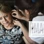 Profile Picture of Aug. 2, 2012 - Stacie Albertson, 42, sat quietly as she had needles put in (@imago-images.de) on Google