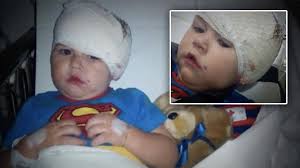 Toddler returns home from hospital after dog attack