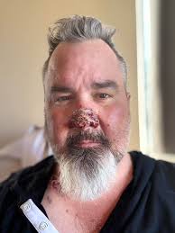 Thank you Daniel Coleman and Betty's Fish and Chips for the delicious  Pear/Raspberry pie. #supportlocal