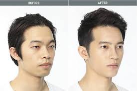 31 Crazy Before And After Photos Of Korean Plastic Surgery Korean Plastic Surgery South Korean Plastic Surgery Cosmetic Surgery