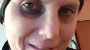 Daniela Molinari cercava la madre per curare un tumore: 'L'ho trovata, non  vuole aiutarmi'