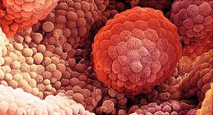 Expressing the brand essence using design is what brings brands alive. What Is Metastatic Prostate Cancer