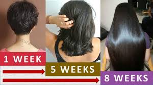 So we decided to reach out to the most knowledgeable experts (specifically, trichologists and dermatologists) to get their take on the topic and to learn what we can. Double Hair Growth Grow Your Hair Very Fast With This Magical Recipe Natural Home Remedies Youtube In 2020 Thick Hair Remedies Grow Hair Hair Growth Faster