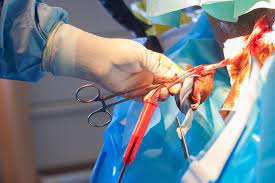 (1)department of obstetrics and gynecology, weill medical college of cornell university, new york, ny 10021, usa. Screening For An Enzyme Defect In Newborns