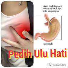 Rawatan pedih ulu hati (heart burn). Nafisah Musa Cara Atasi Pedih Ulu Hati
