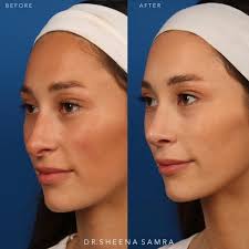 🙏🏼Beyond blessed to have been welcomed with open arms and hearts by Dr. Keith  Marcus, his amazing team, and the South Bay community. Thank you all for an  incredible year ❤️ @drkeithmarcus @