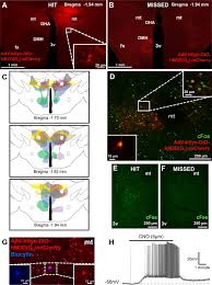 Leptin receptor neurons in the dorsomedial hypothalamus are key regulators  of energy expenditure and body weight, but not food intake