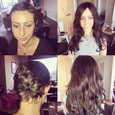 A doctor has issued a warning to women using hair extensions, highlighting how wearing them can lead to hair loss and even baldness. Monday Motivation Brought To You By Another Successful Hair Transformation This B Hair Transformation Chemotherapy Hair Loss Hair Extensions Before And After