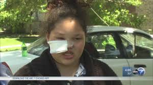 12-year-old attacked by pit bull in Stickney while walking home