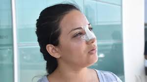 Pide justicia pareja golpeada en la feria; sólo hay un detenido